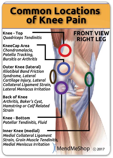 10 Common Knee Injuries & Diseases