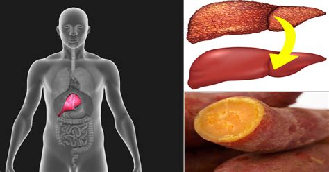 10 Foods & Supplements That Reverse Liver Disease - Just Naturally Healthy