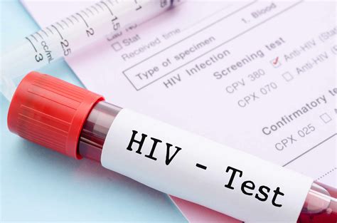 HIV Test – Types, Procedure, Importance and Results - Dr Lal PathLabs Blog