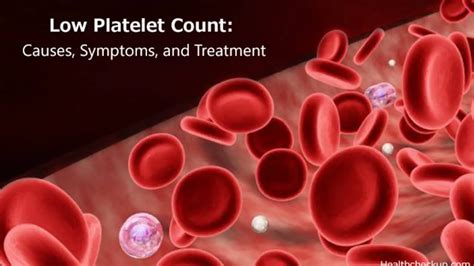 Low Platelet Count (Thrombocytopenia): Causes and Symptoms | Healthtian