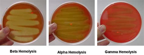 محیط کشت blood agar / محیط کشت میکروبی- میکروبیولوژی | www.ktglabgroup.com