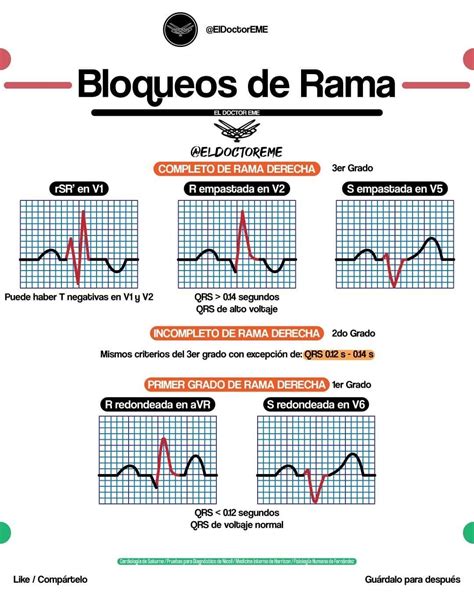 Pin de Hugo Fernando Velarde Contrera en Bloqueos cardíacos | Cosas de ...