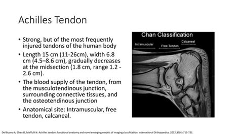 Achilles Tendon Lengthening.pptx