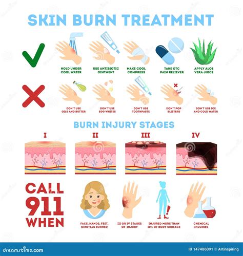 Skin Burn Injury Treatment And Stages Infographic Vector Illustration ...