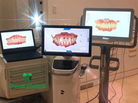 iTero Element 5D Intraoral Scanner - Universadent