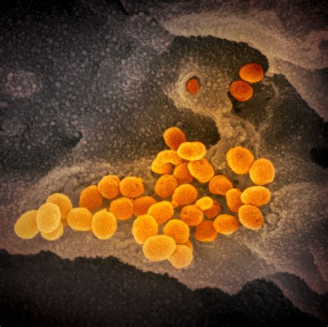 IMAGES: What New Coronavirus Looks Like Under The Microscope : NPR