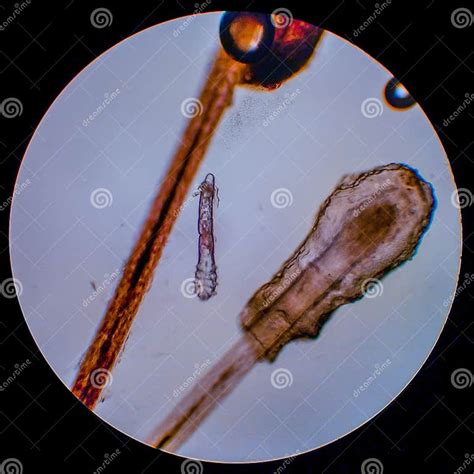 Demodex Folliculorum - Parasitic Mite on the Eyelashes of a Human Eye ...