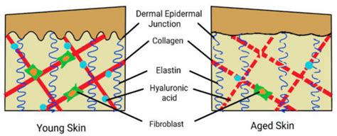 Life | Free Full-Text | Aging and Wound Healing of the Skin: A Review ...