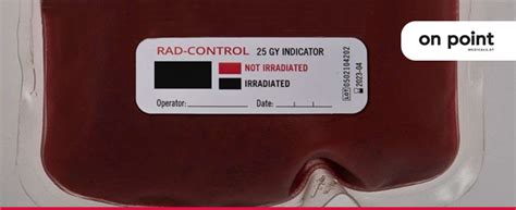 Blood irradiation: Do not assume, verify! - Abacus dx