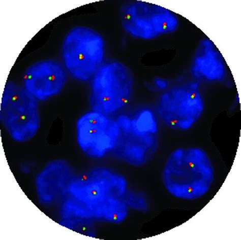 Cytocell FISH Probes - Sysmex New Zealand