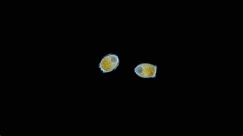 Trochophore Larvae Under Microscope Possibly Stage Stock Footage Video (100% Royalty-free ...