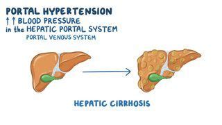 Melena: What Is It, Causes, Symptoms, Bleeding, Treatment, and More | Osmosis