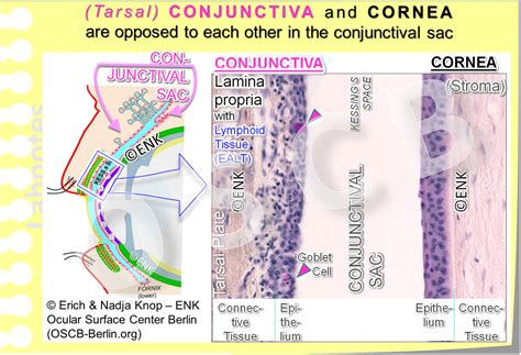 The Conjunctiva — Ocular Surface Center Berlin