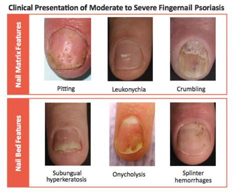 #PsoriasisTreatmentWithKangenWater Product ID:8364851109 # ...