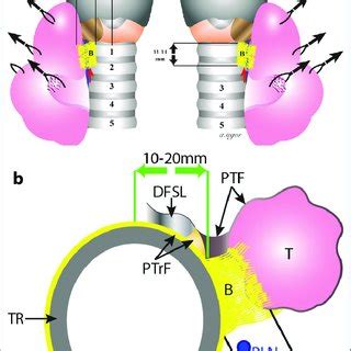 The inferior approach to the recurrent laryngeal nerve. RLN: Recurrent ...