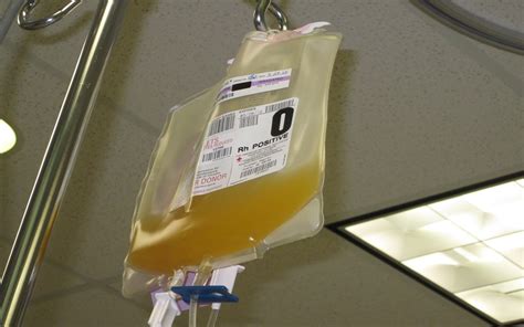 10 Importance of Platelet Transfusion | Thrombocytes