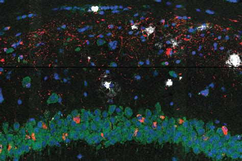 The Brain Tour Alzheimer S Disease - Infoupdate.org