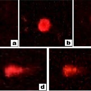 Comet assay visualization by epifluorescence microscopy. Comet tail ...