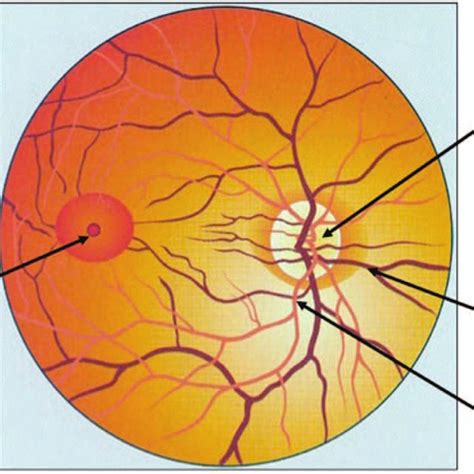 Normal ocular fundus. | Download Scientific Diagram