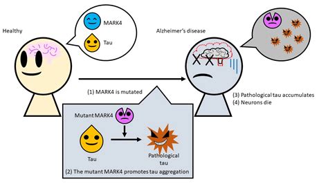 Cause of Alzheimer’s Disease Traced to Genetic Mutation in Common Enzyme