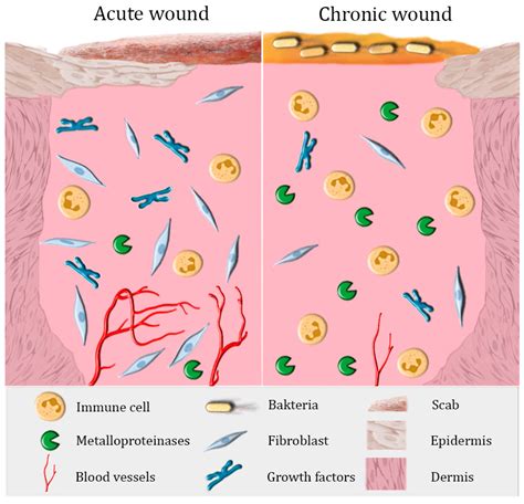 Applied Sciences | Free Full-Text | Modifications of Wound Dressings with Bioactive Agents to ...