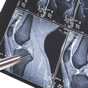 Limitations of MRI muscle injury classification system