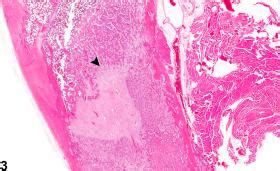 Bone - Callus - Nonneoplastic Lesion Atlas