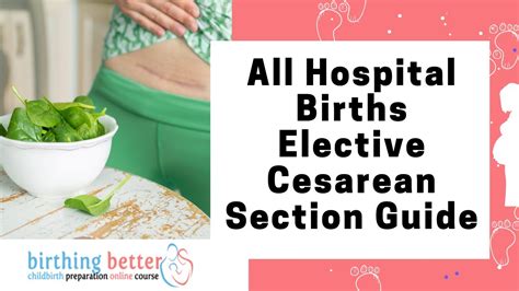 All Hospital Births Elective Cesarean Section Guide | Benefits of Elective C Section - YouTube