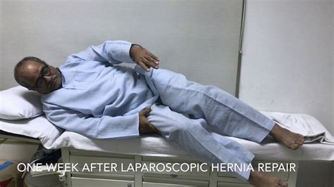 Recovery after Laparoscopic Hernia Repair - YouTube