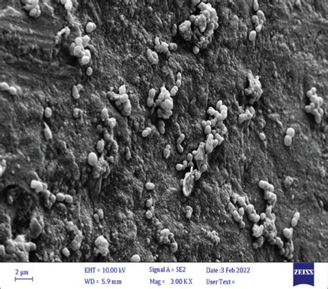 E. faecalis biofilm formation confirmed by the Scanning Electron ...