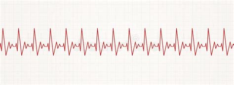 Fast heartbeat – Telegraph