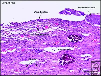 Granulation tissue with interspersed inflammatory cells is present in... | Download Scientific ...