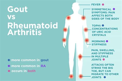 Gout vs. Rheumatoid Arthritis: What’s the Difference?