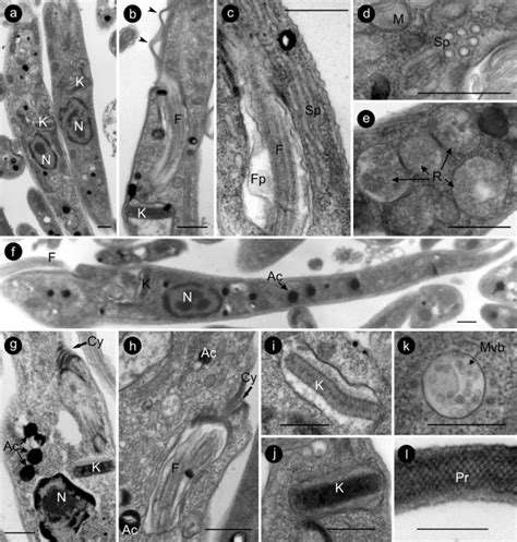 Transmission electron microscopy showing the ultrastructural... | Download Scientific Diagram