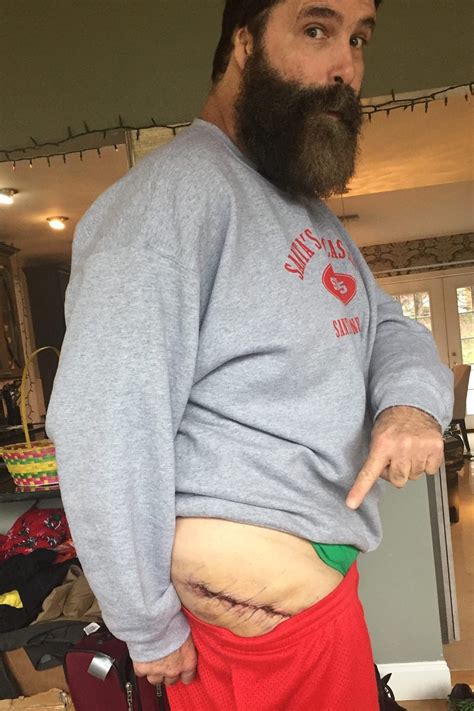 Mick foley shows off gnarly scar following hip surgery. - scoopnest.com