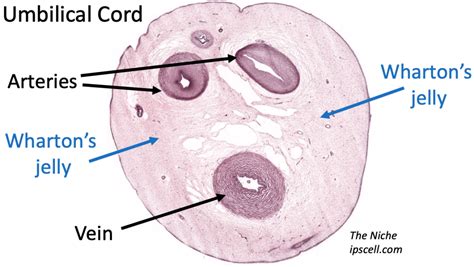 What is Wharton's jelly & its possible clinical uses? - The Niche