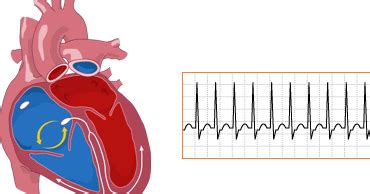 Pansystolic Murmur Symptoms, Causes, Sound, Treatment - Health Care ...