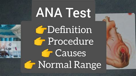 ANA Test | ANA Test Positive | antinuclear anti body test | Procedure - YouTube