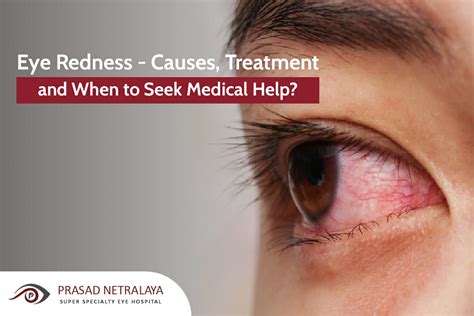 Treatment For Eye Redness - Prasad Netralaya