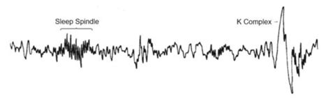 Sleep spindles and K complex | Download Scientific Diagram