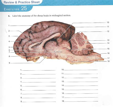 Brain Anatomy Quiz