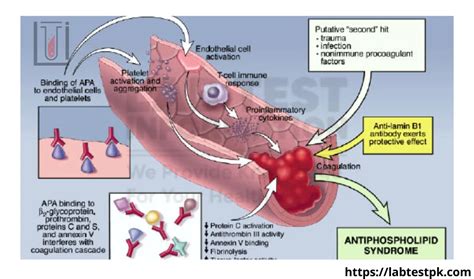 Lupus anticoagulant Syndrome| Lab Test Information