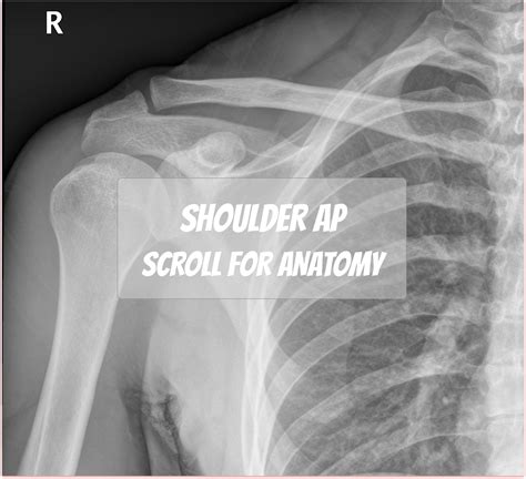 Shoulder Anatomy Diagram - Muscles Of The Shoulder Anatomy Pictures And Information