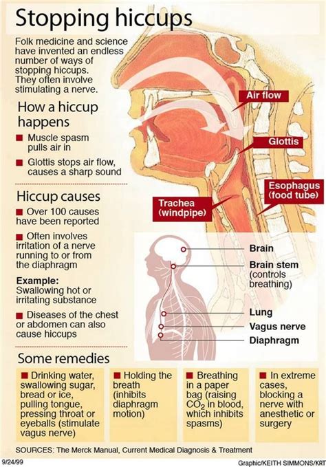 Hiccups; The causes and how to cease them. - Stopping hiccups Folk medicine and science have ...