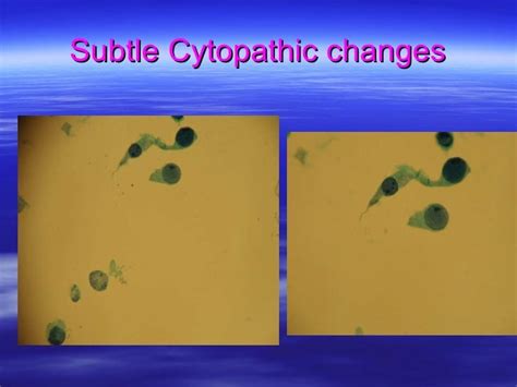 Cytopathic Effects Of Viral Infections