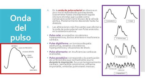 Pulsos e ondas – Trabalho de formatura