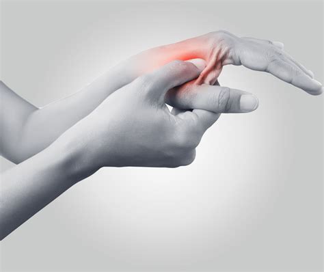 Carpal Tunnel Syndrome - Jonathan Cheng, MD, FACS