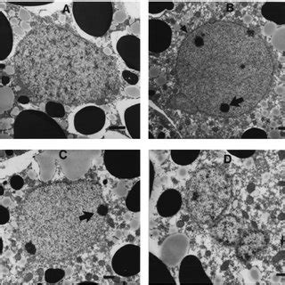 Electron micrographs reveal morphological features typical of apoptotic... | Download Scientific ...