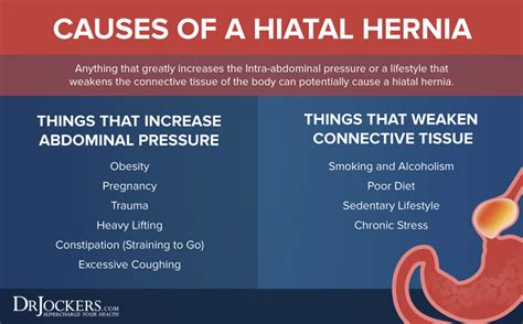 How To Prevent Hiatal Hernia - Birthdaypost10