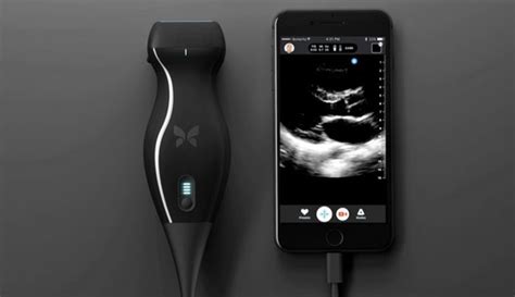 Butterfly iQ : portable ultrasound machine - smartphone-based - https://debuglies.com